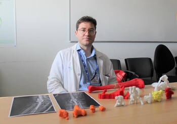El Sescam utiliza la impresión 3D para reproducir huesos